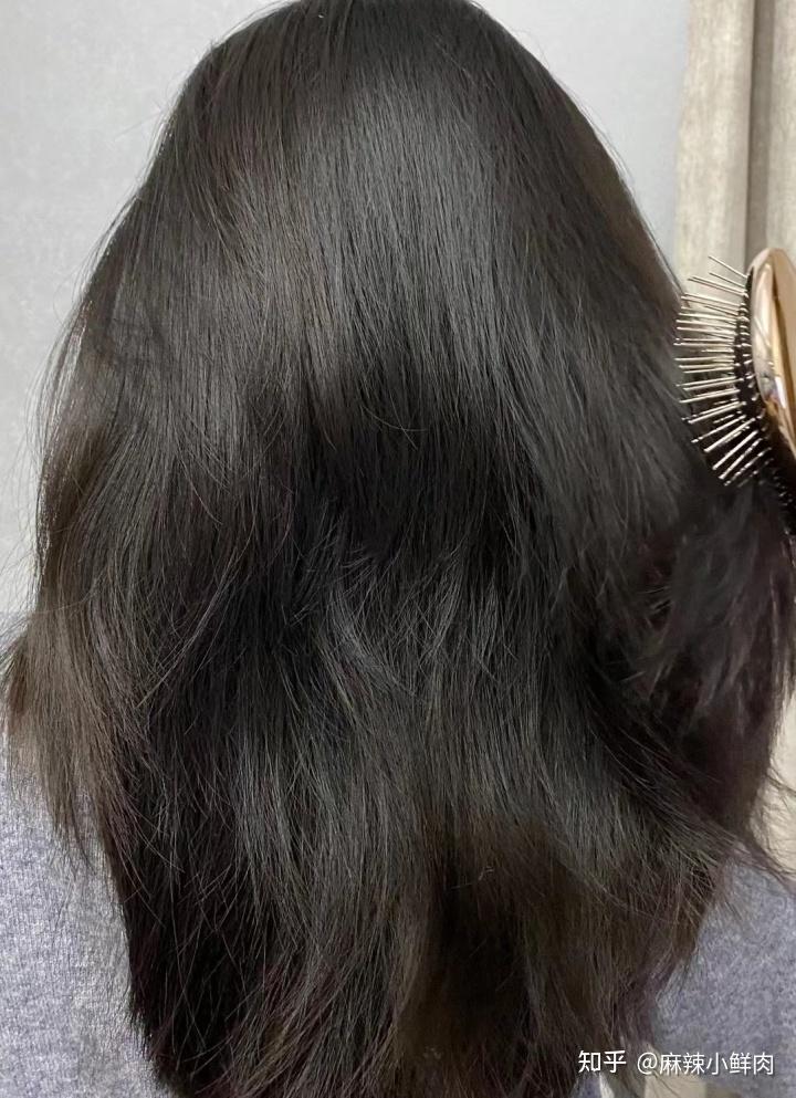 头皮屑多爱出油洗不干净还脱发严重有什么洗发水能拯救