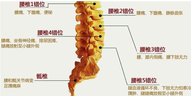 腰椎1~7节位置图图片