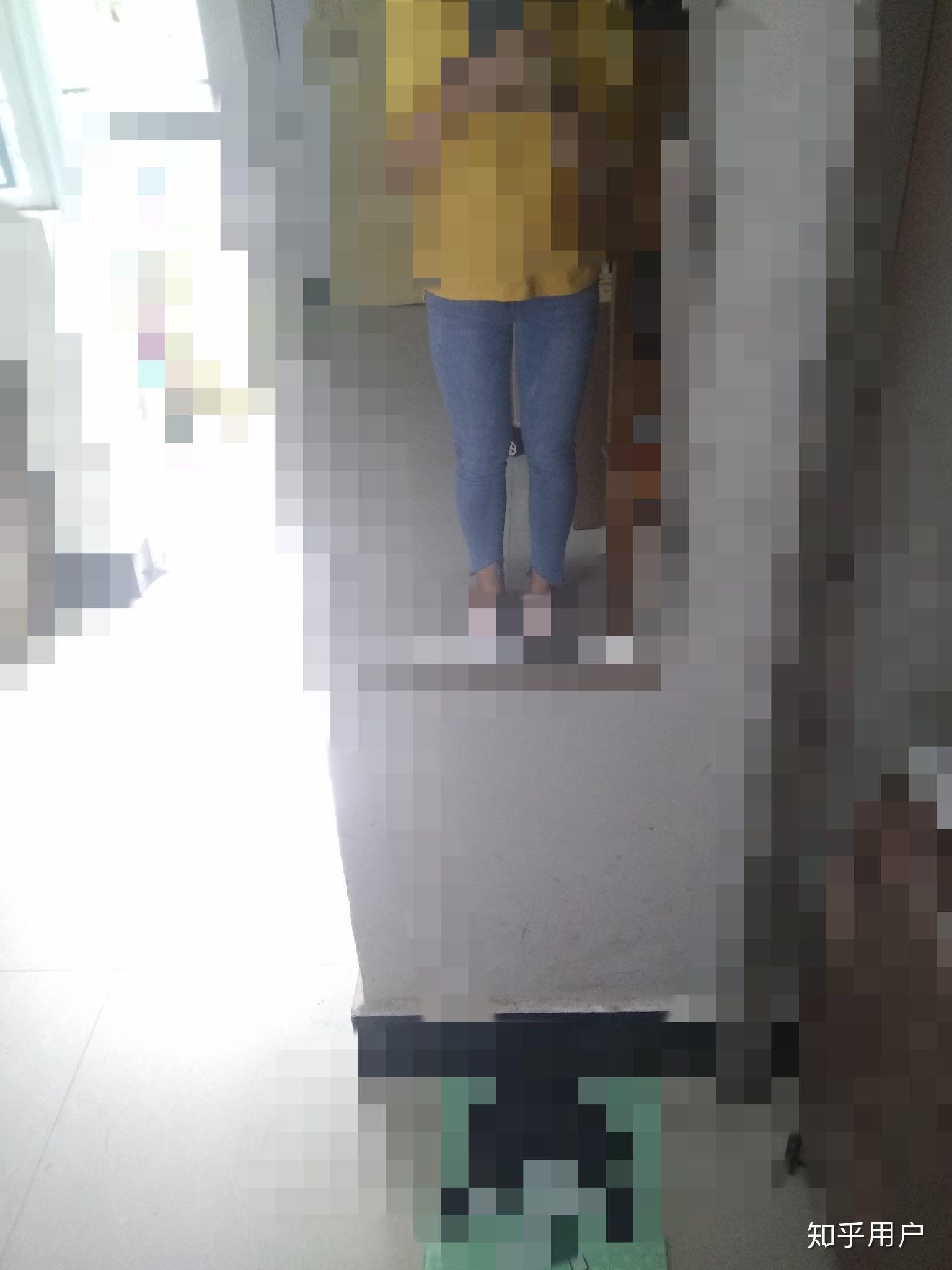 大腿前侧的肌肉过于发达怎么办?