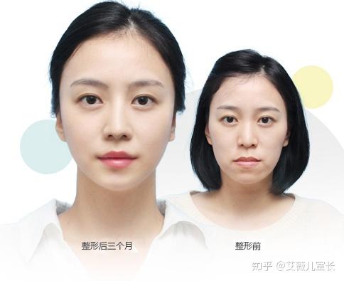 韩国整形医院那么多 哪家比较好 如何选择整形医院呢 室长有话说 知乎
