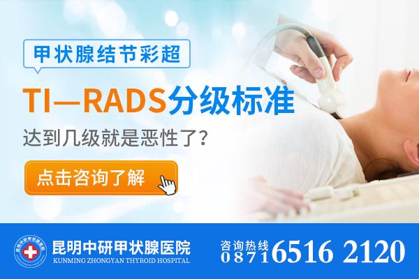 v2-a3aad4f8c6b3e3ccb37e34b6700d4bb7_1440w.jpg?source=172ae18b