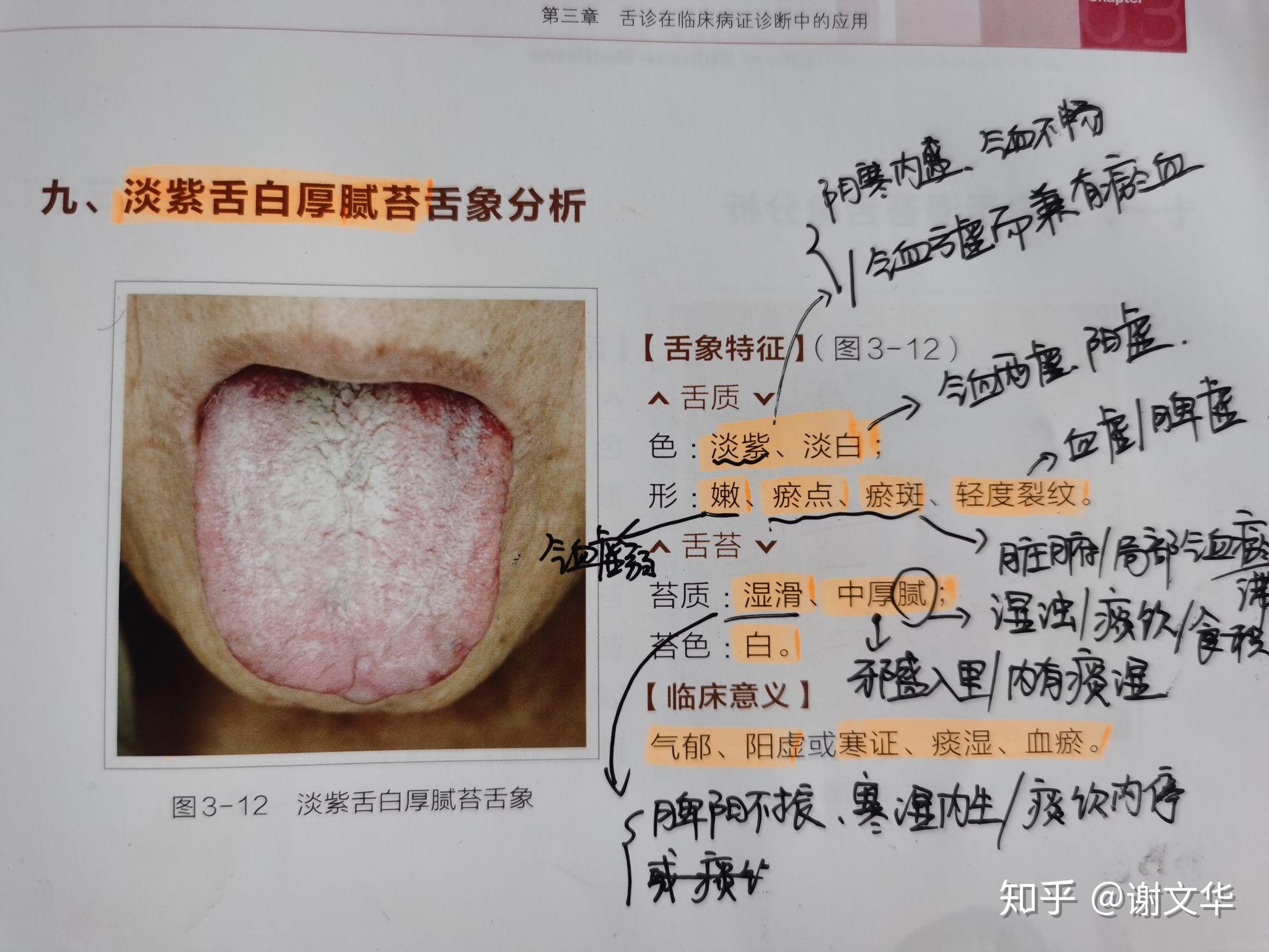 淡紫舌白厚腻苔