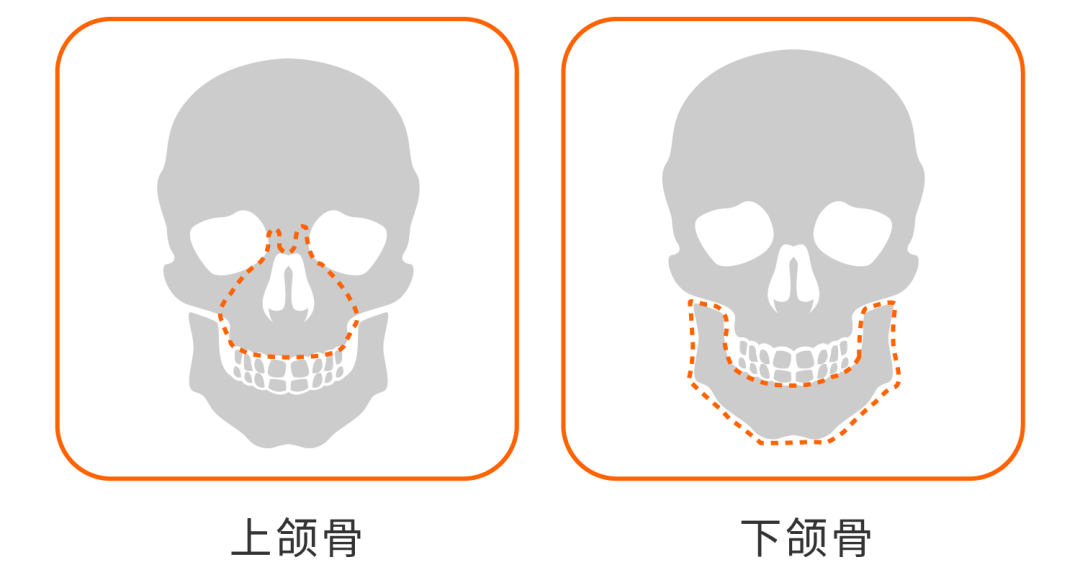 而下半张脸的骨相主要在于上颌骨和下颌骨的位置关系,他们在整个面部