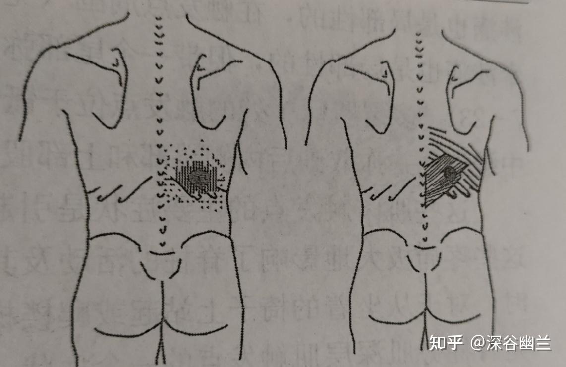 下后锯肌起止点图片