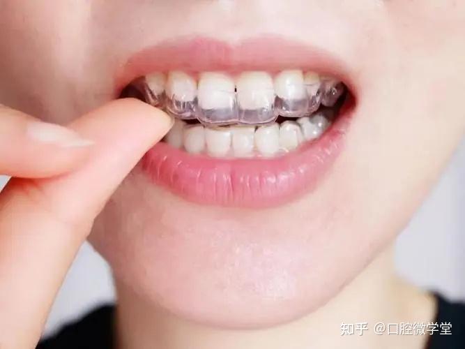 北京隐形矫正牙齿哪里比较好牙齿矫正的流程是什么