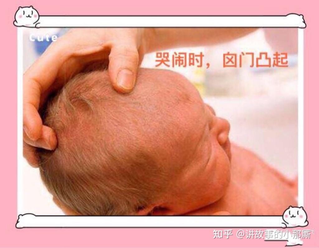 宝宝的囟门你了解多少？ - 知乎