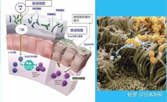 肠道黏膜是体内&体外极其重要的防护隔离墙