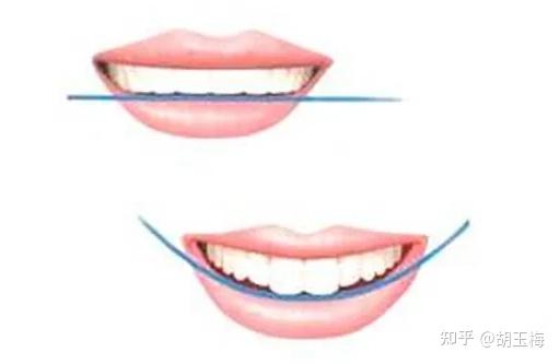 完美笑线丨你不知道的关于笑容的秘密 - 知乎