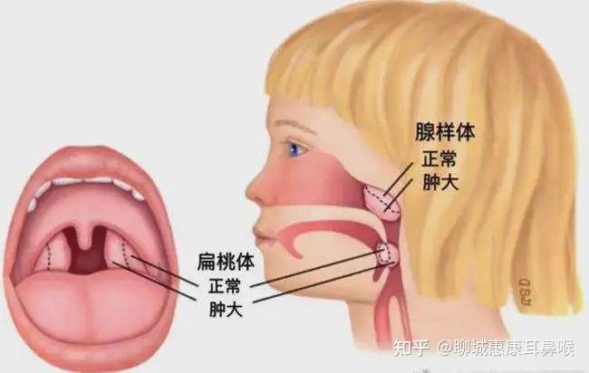 耳鼻喉相通图片图片