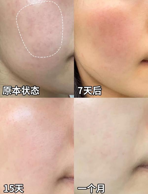 孕妇护肤保养_孕妇该如何护肤保养_护肤保养步骤