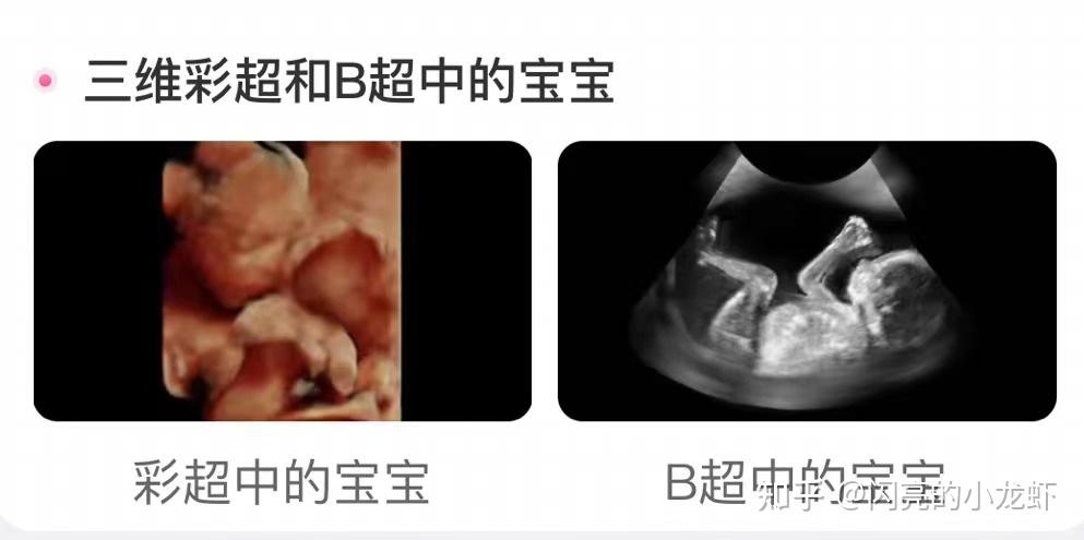 胎儿1-40周完整详细的发育过程记录(彩超/B超图) - 知乎