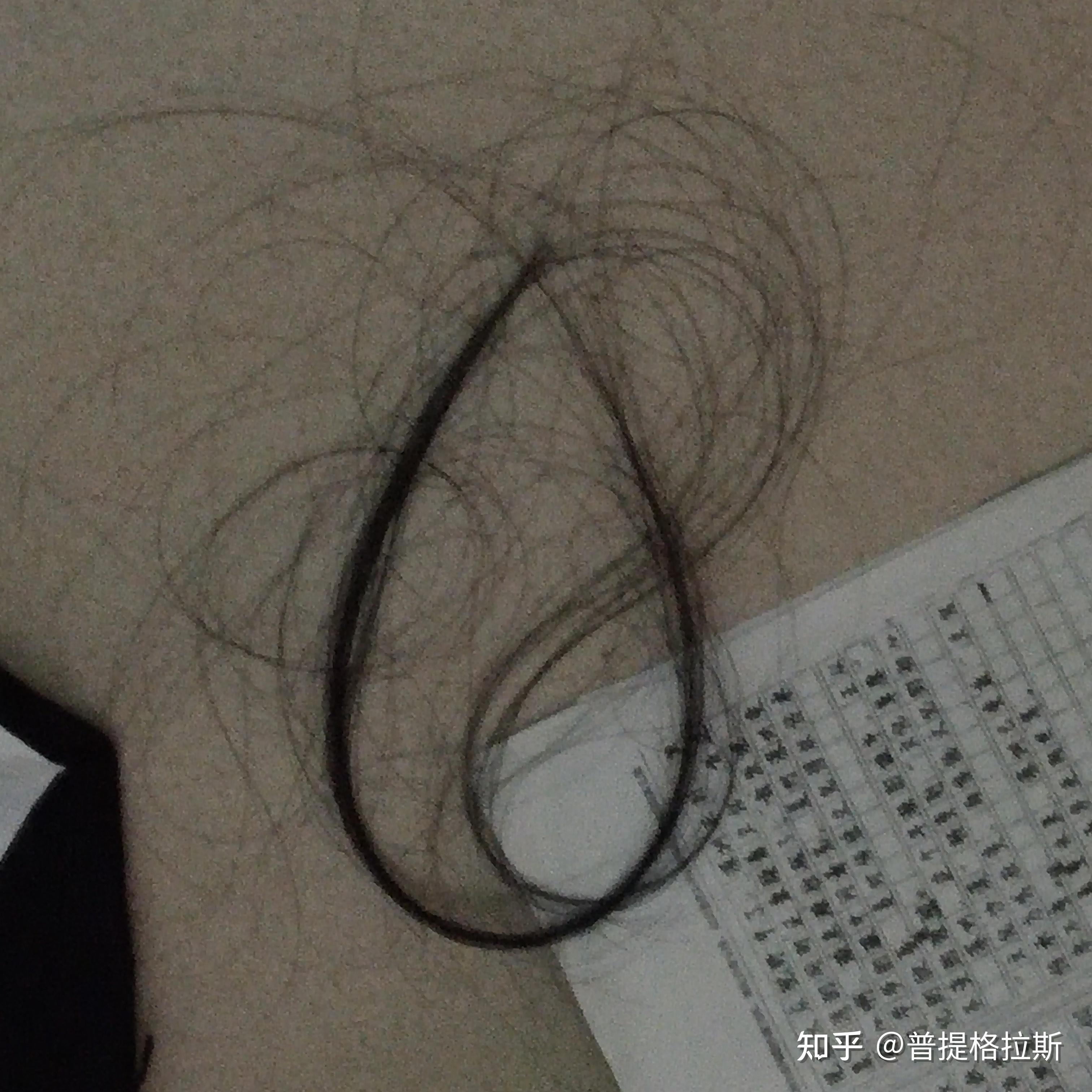 初中生掉头发多少算正常?