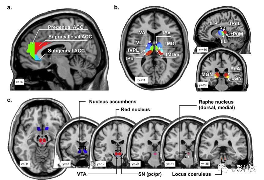 neuroimage自动解剖标记图谱第三版