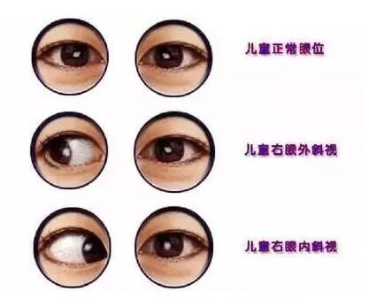 你知道什么是弱视吗 孩子弱视远比你想象的严重 知乎