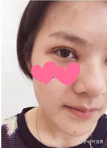 四川自贡有哪些整形医院啊割双眼皮哪家好一点