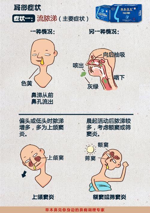 你把鼻炎当感冒你知道有什么后果