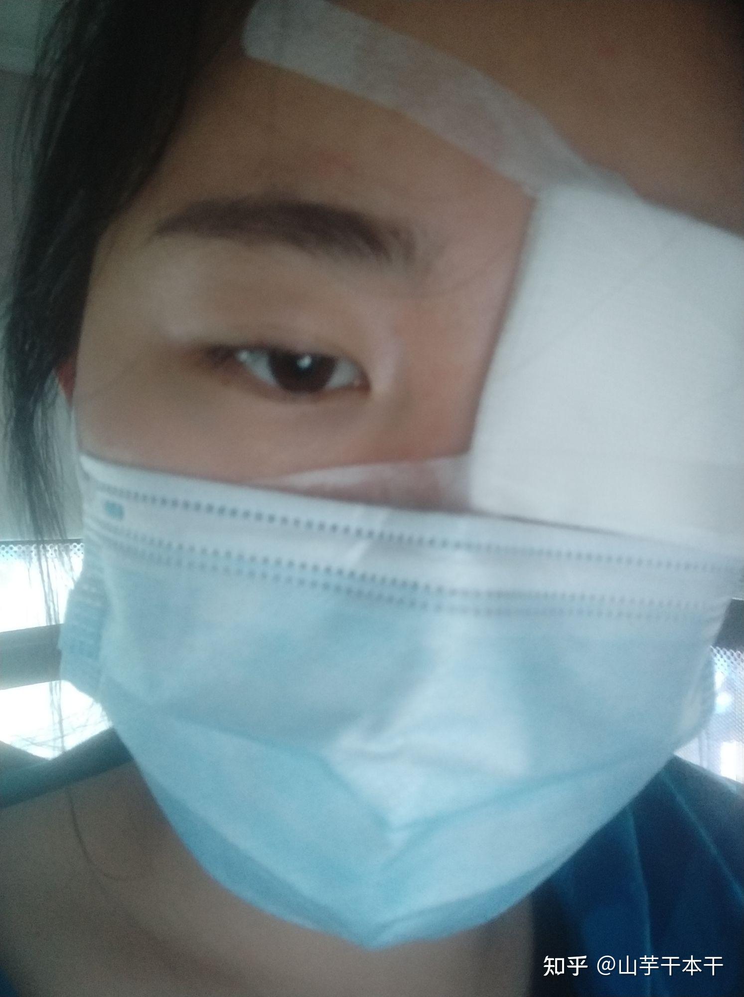 记一年麦粒肿及霰粒肿患者手术过程