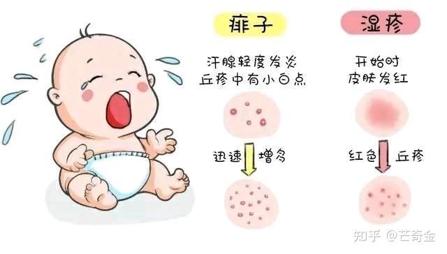 实用！宝宝常见“疹疹”问题对照分辨护理 - 知乎