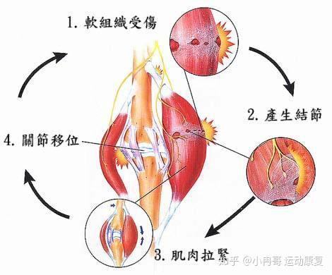 韧带和肌腱的区别 知乎
