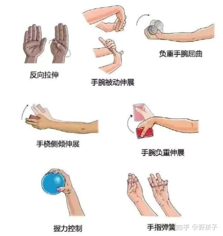 腱鞘囊肿怎么按 - 知乎