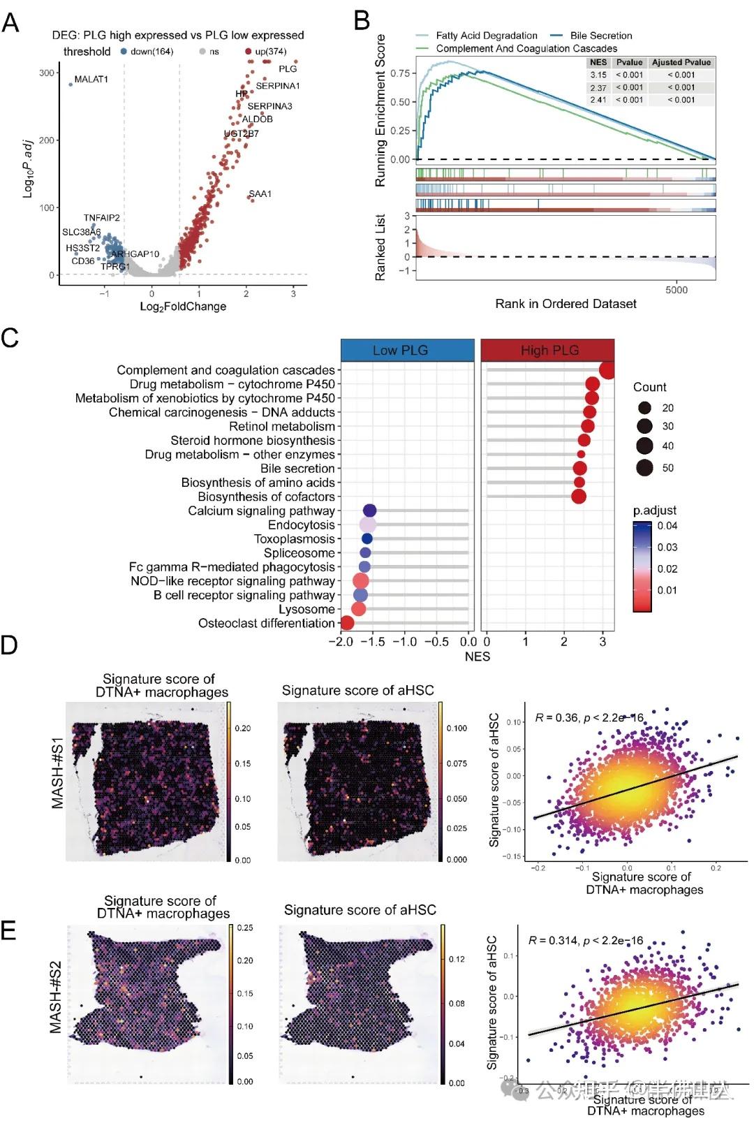 最新15+纯生信，单细胞+空转+bulk+ATAC-seq+机器学习，识别疾病进展相关细胞亚型。最新高分思路，肿瘤非肿瘤均合适！ - 知乎