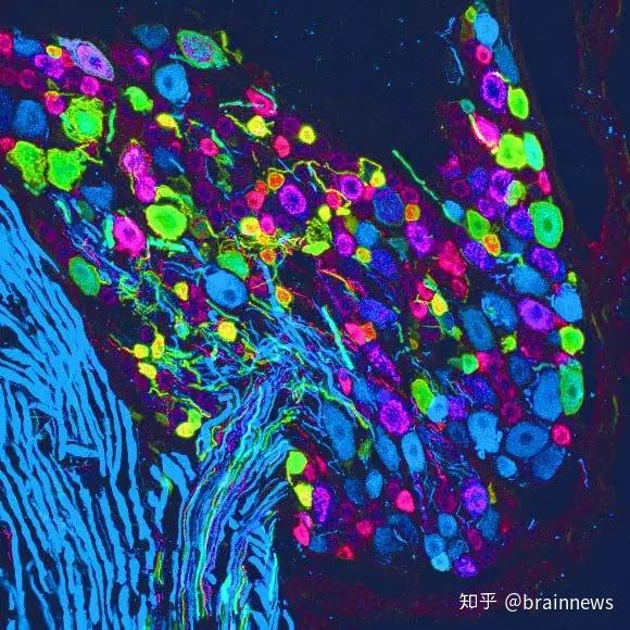 疼痛的 疼痛的英文 疼痛的形容词