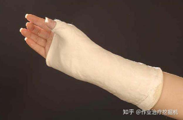 稳定性手舟骨骨折,拇指该不该固定?