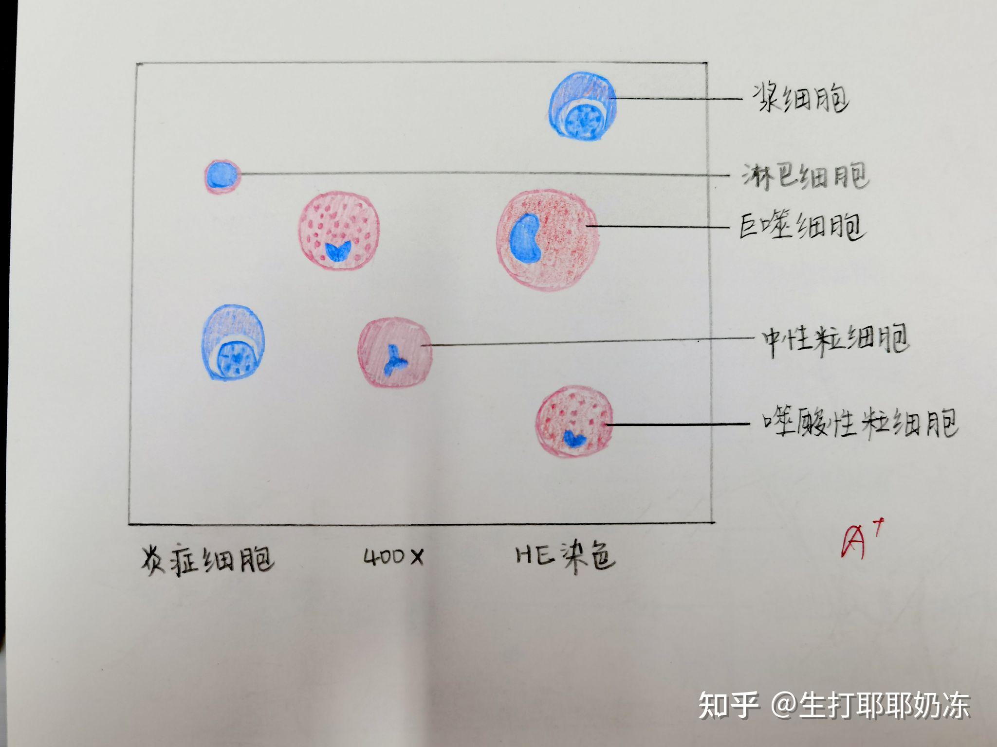 单核巨噬细胞红蓝铅笔图片