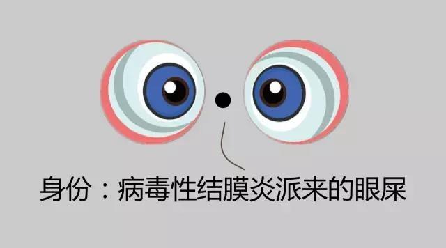 危险指数:8282828282警惕:病毒性结膜炎相貌:肤色偏白,中等