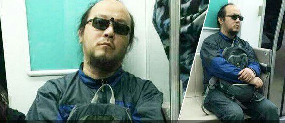 种植发际线安全吗,为什么几乎没见过女明星做