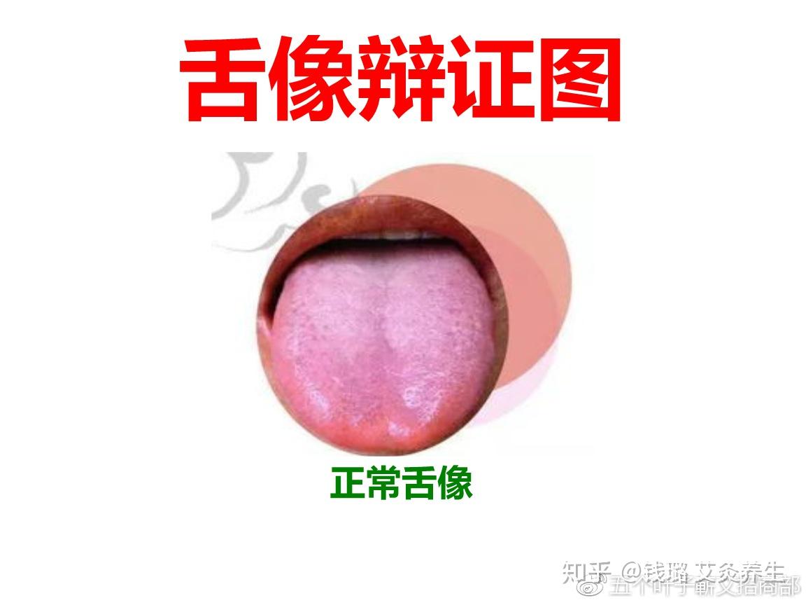 6767八綱辨證,臟腑辯證,看舌是重要內容,首先