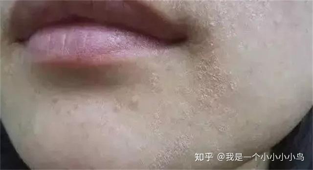 干皮的你真的知道怎么护肤吗？做好这3点让你皮肤好到爆 - 知乎