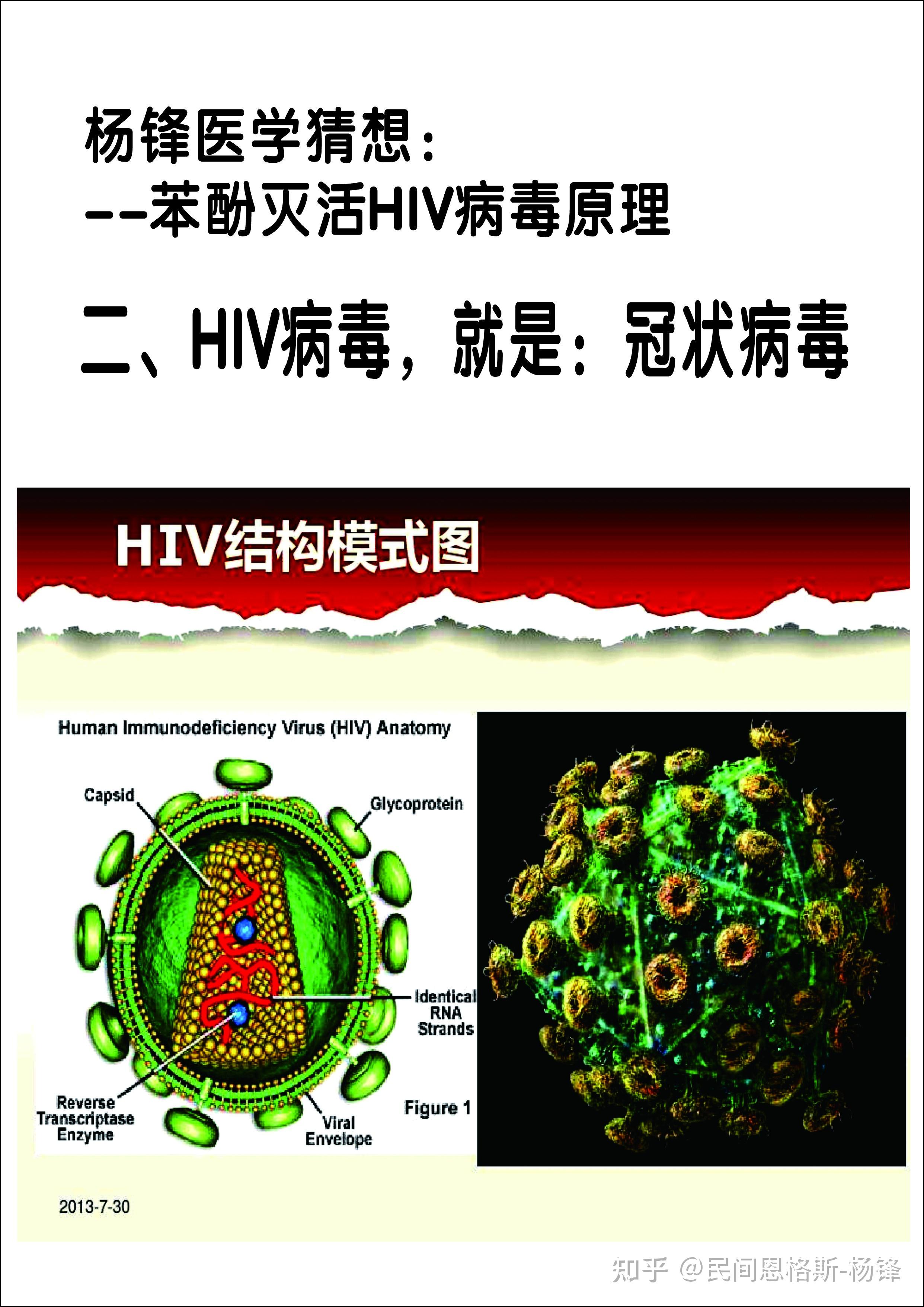 醫學猜想假說苯酚滅活hiv艾滋病病毒的原理苯酚抗hiv艾滋病病毒的原理