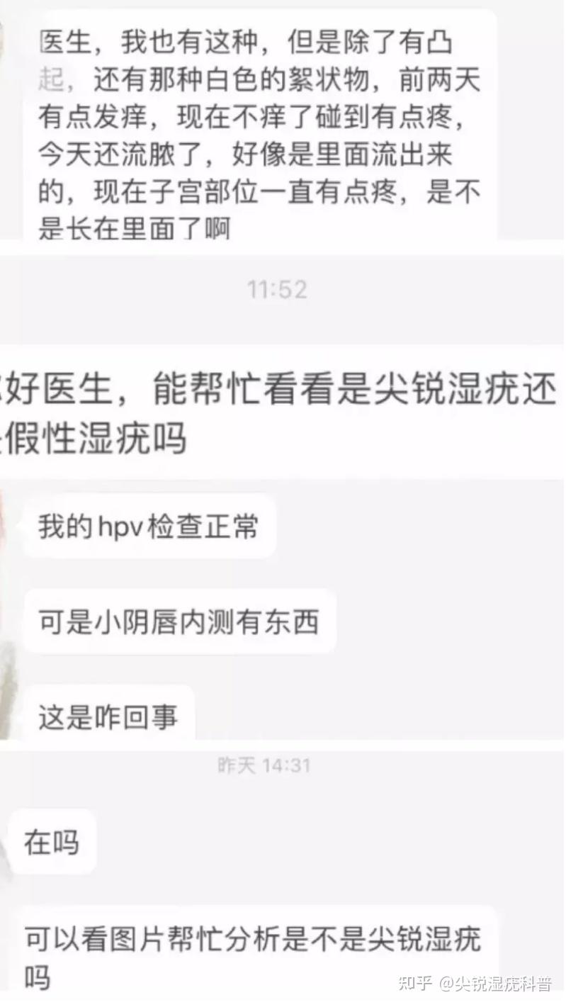 怎么判断得了尖湿锐疣图片