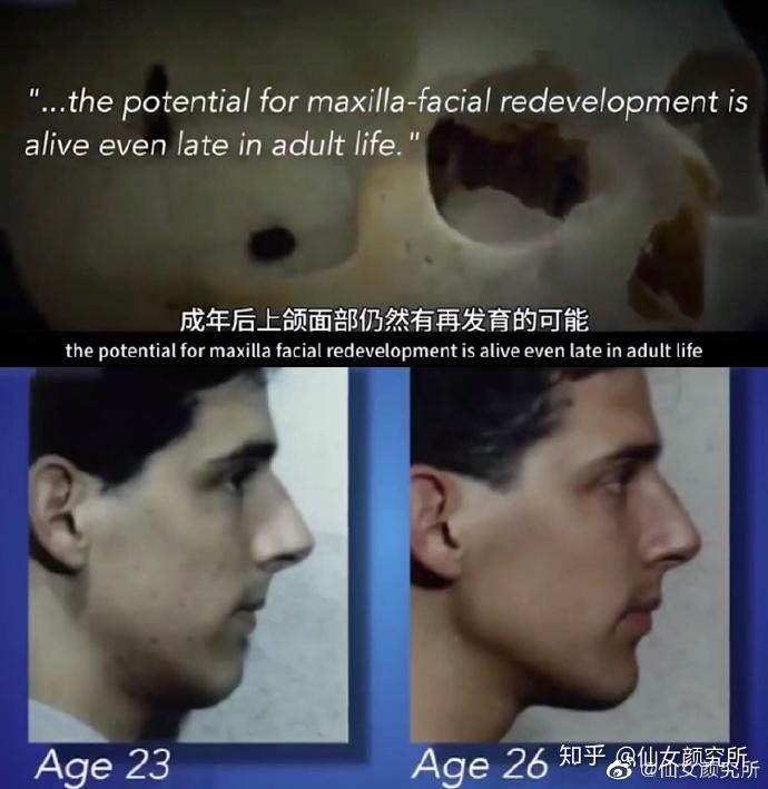 舌头摆放的位置也会影响一个人的脸型