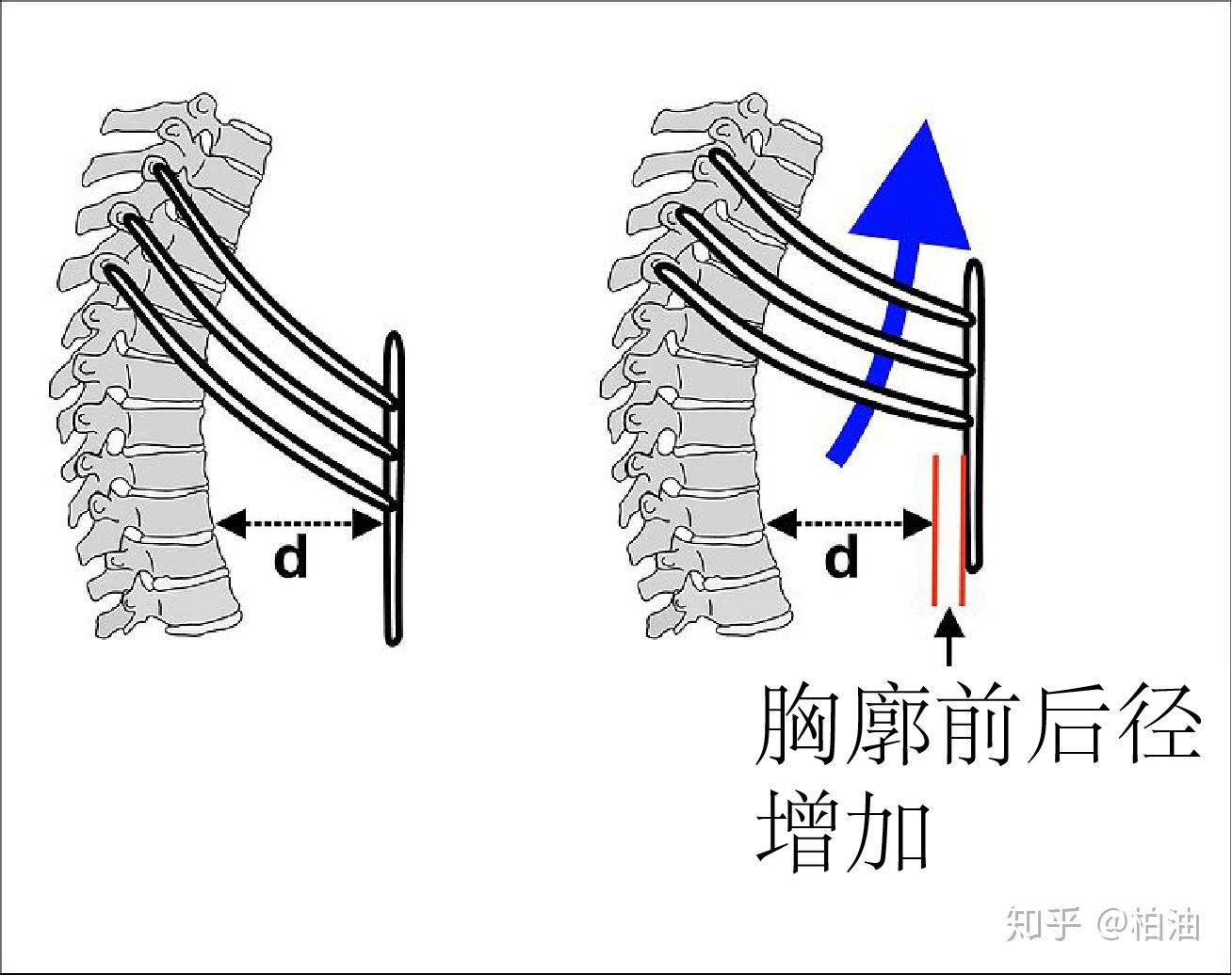 这两种运动的结果是胸廓上抬,同时前后直径增加如下图所示