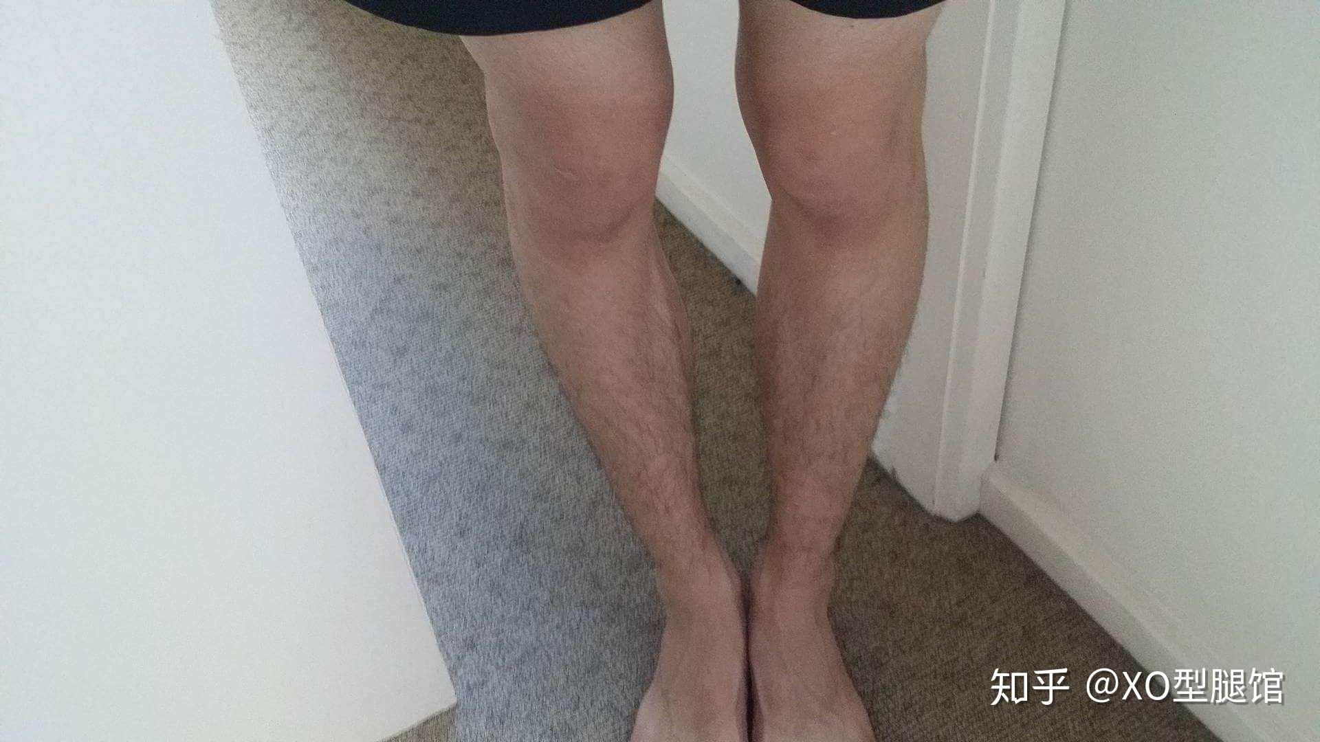 男生完美腿型图片
