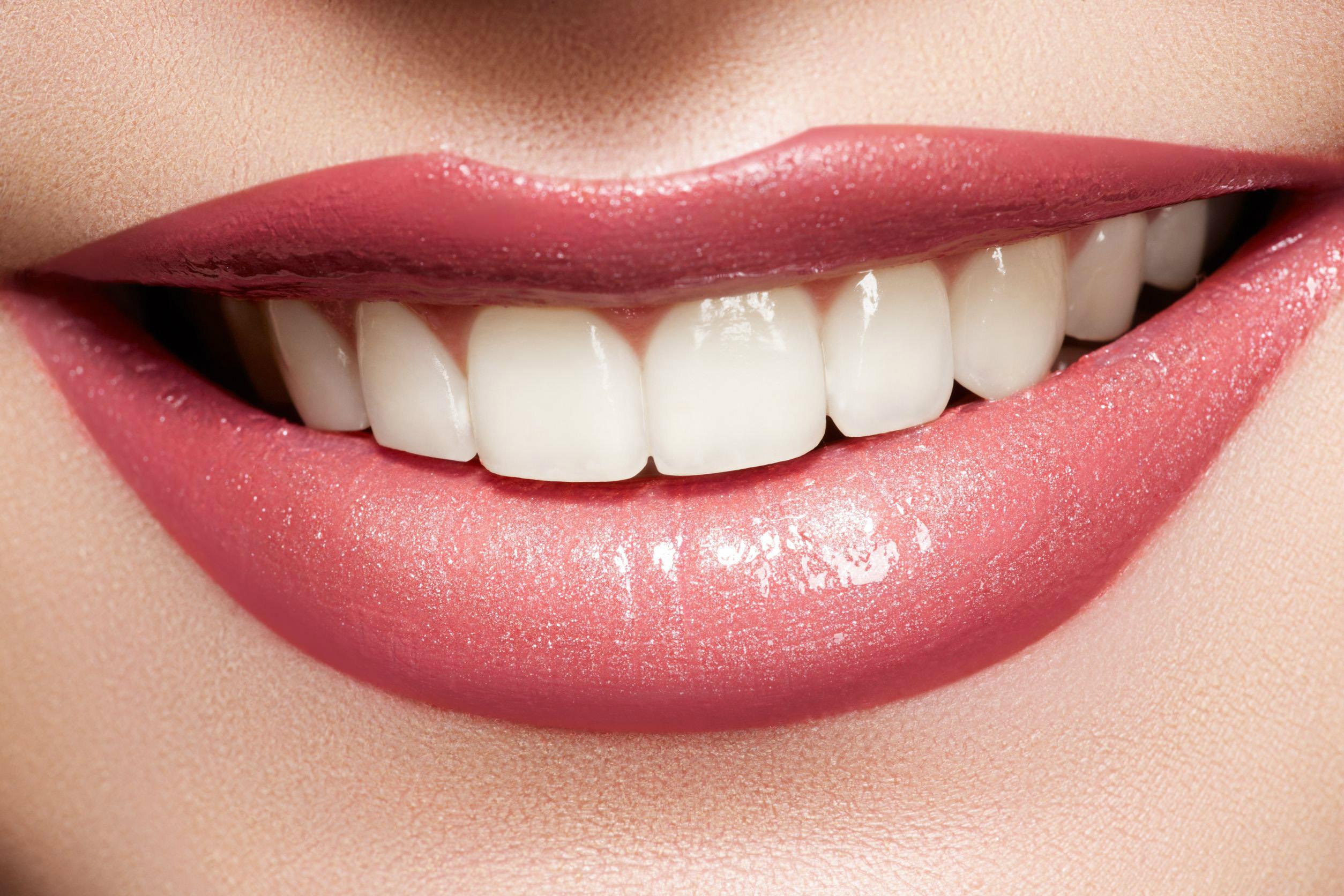 牙周是否健康 从颜色就能看出_美哈口腔