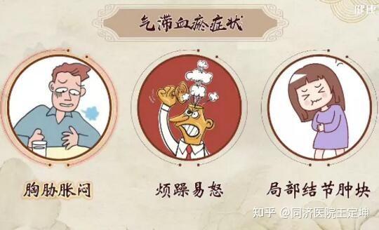 中医肿瘤病机之气滞血瘀 - 知乎