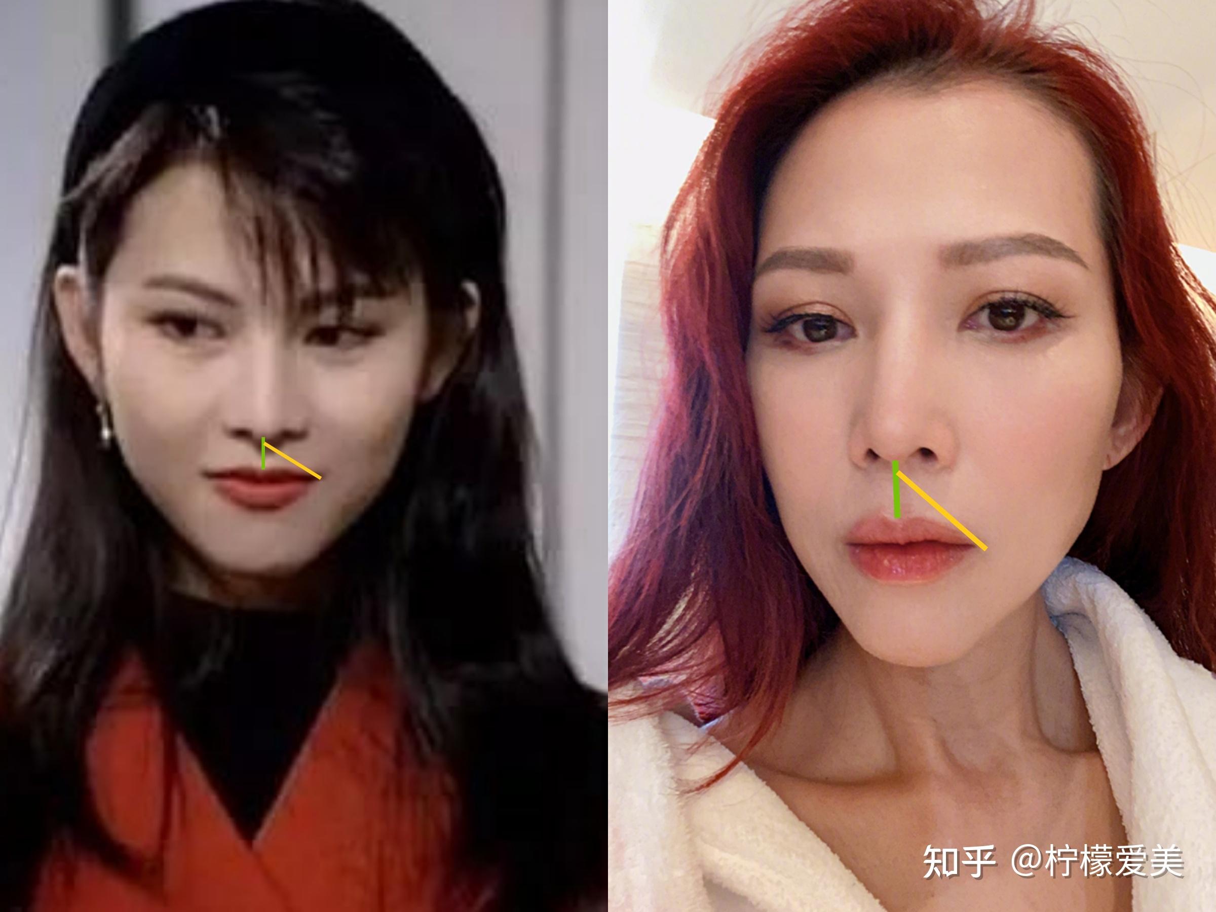 昔日甜妹蔡少芬,为什么会越长越显凶?苹果肌也快下垂到嘴角