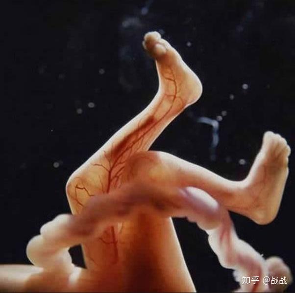四个月胎儿图男孩图片