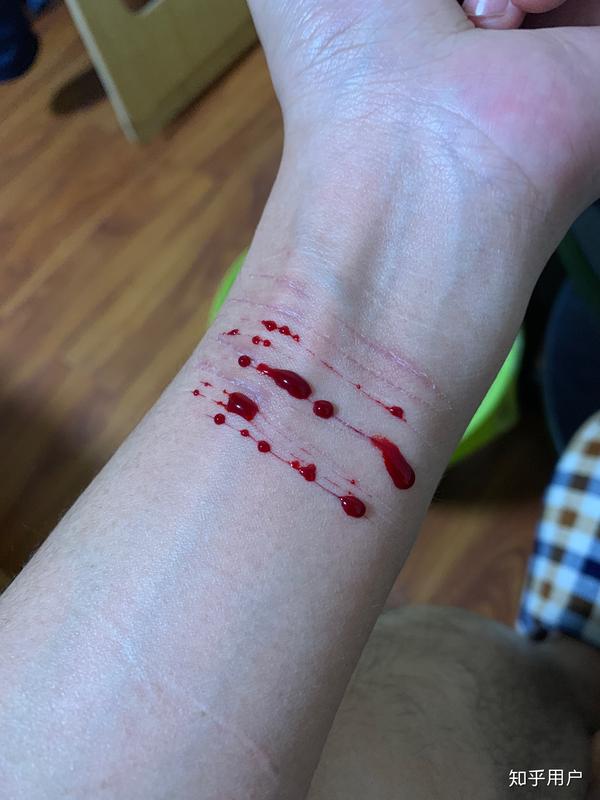 手腕流血的图图片