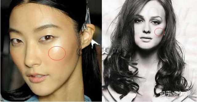 你到底是颧骨高还是太阳穴凹陷
