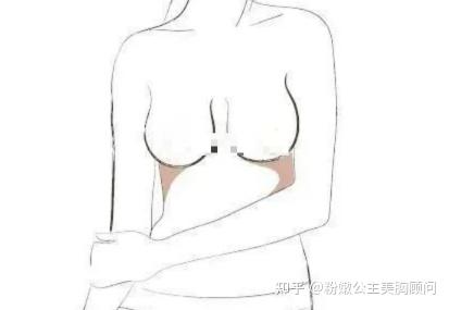 女生的胸部 有几种形状 女性必知哦 知乎