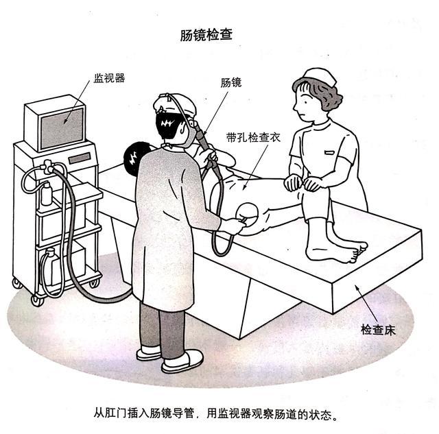 肠镜的镜身较软,插人肛门不会引发疼痛感,还可以观察到直肠更深的部位。超声检查超声检查是向人体发出超声