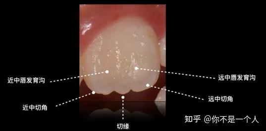 牙齿发育沟图片是什么图片