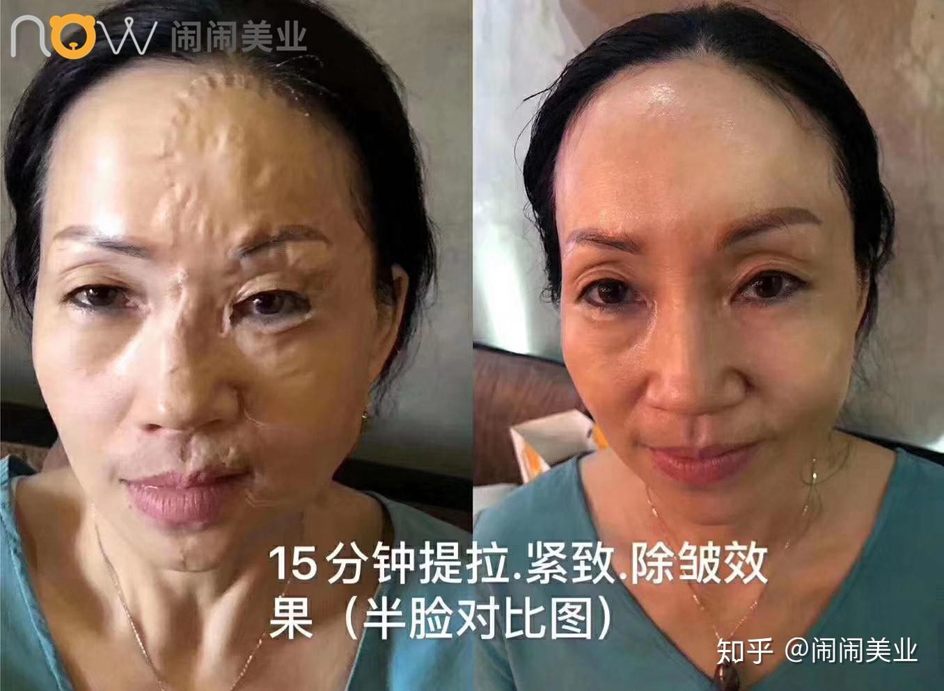 当面部胶原蛋白流失时你该警醒了