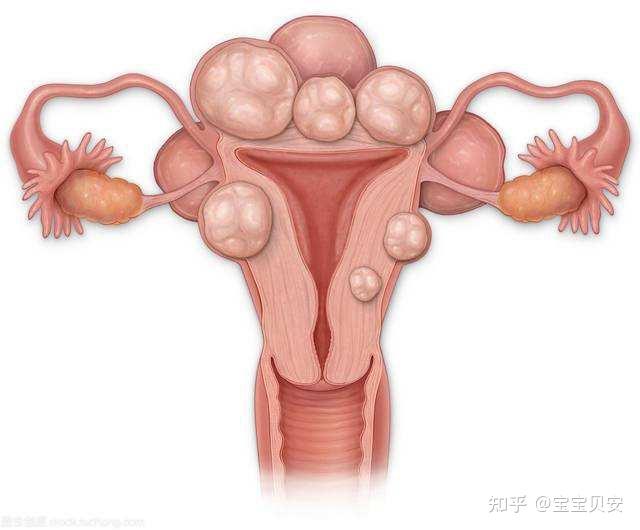 宫颈囊肿饮食方面需要注意什么?