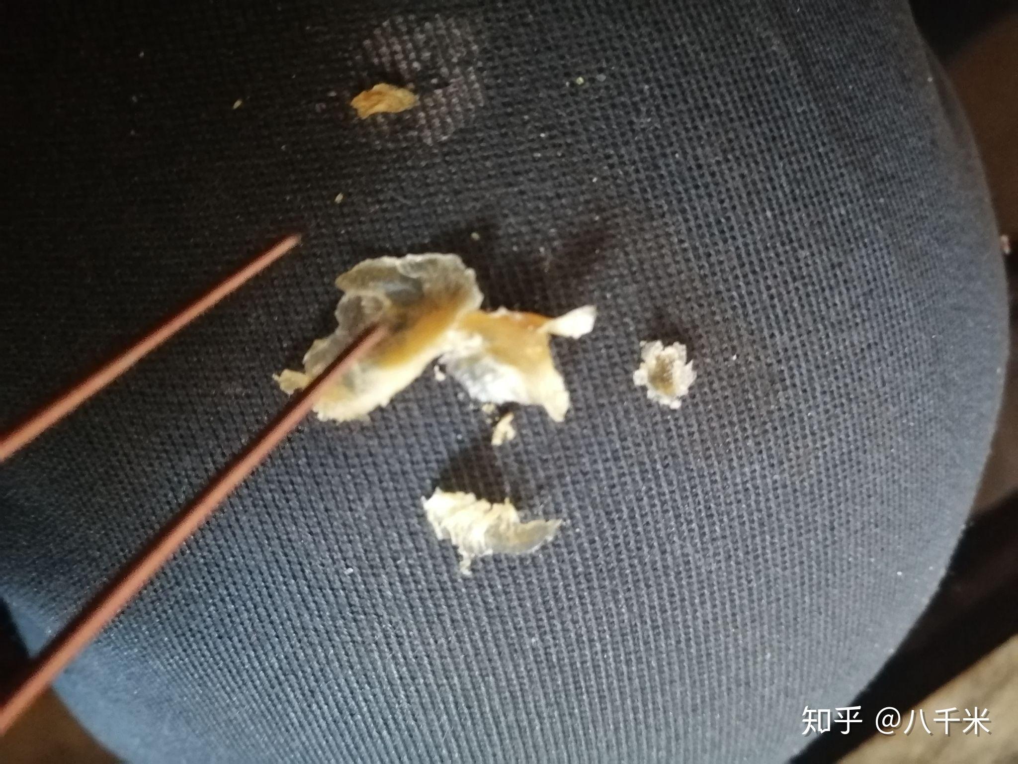 耳屎最大能有多大