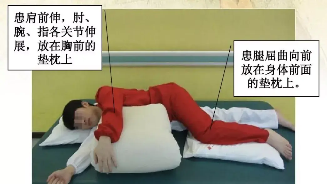 图解脑卒中康复运动功能训练